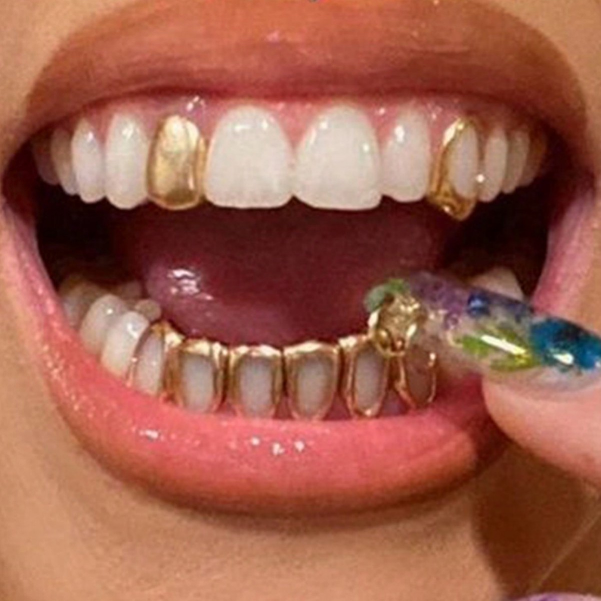 Body Jewelry Hot - Oferta Especial: Brackets Dentales Hip-Hop de